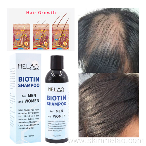 Biotin Hair Shampoo For Men And Women